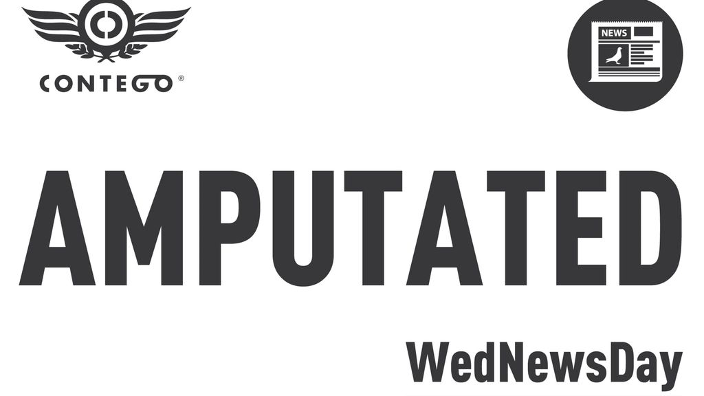 Amputated