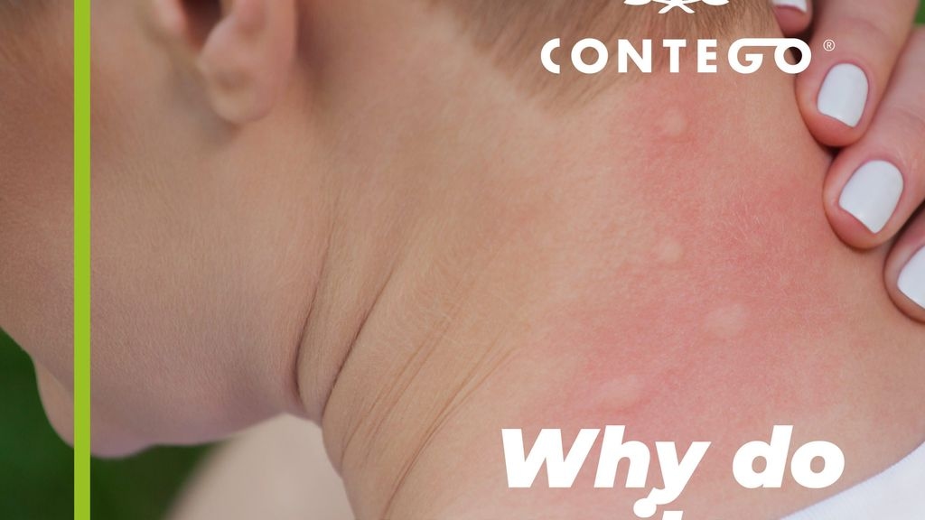 Why Do Mosquitoes Bite Humans?